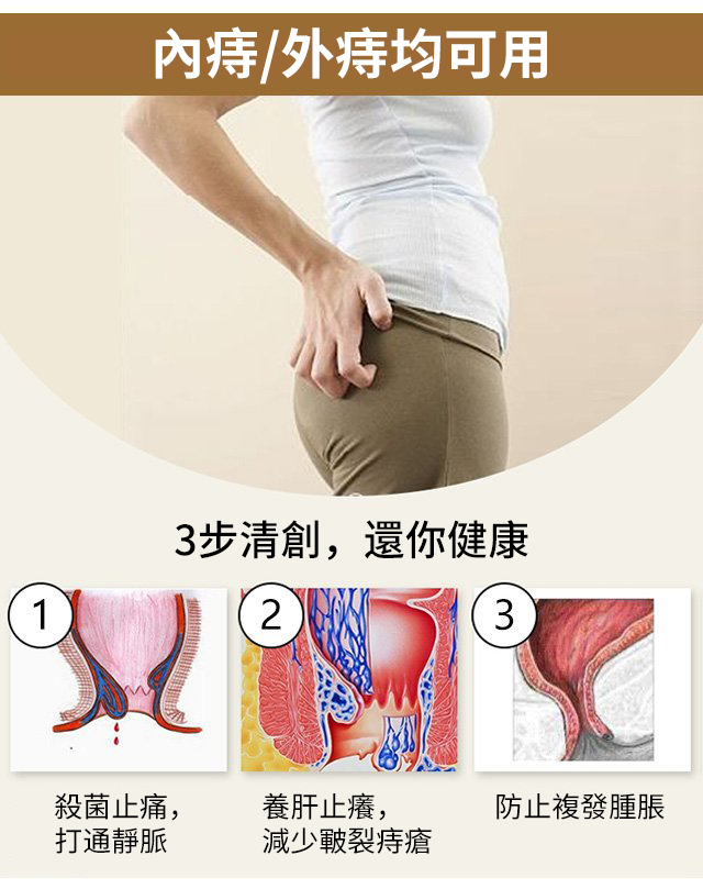 1635484683 11 EELHOE天然草藥噴霧舒緩腫脹痔