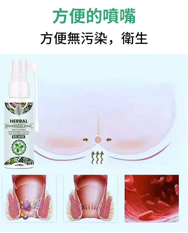 1635484693 15 EELHOE天然草藥噴霧舒緩腫脹痔