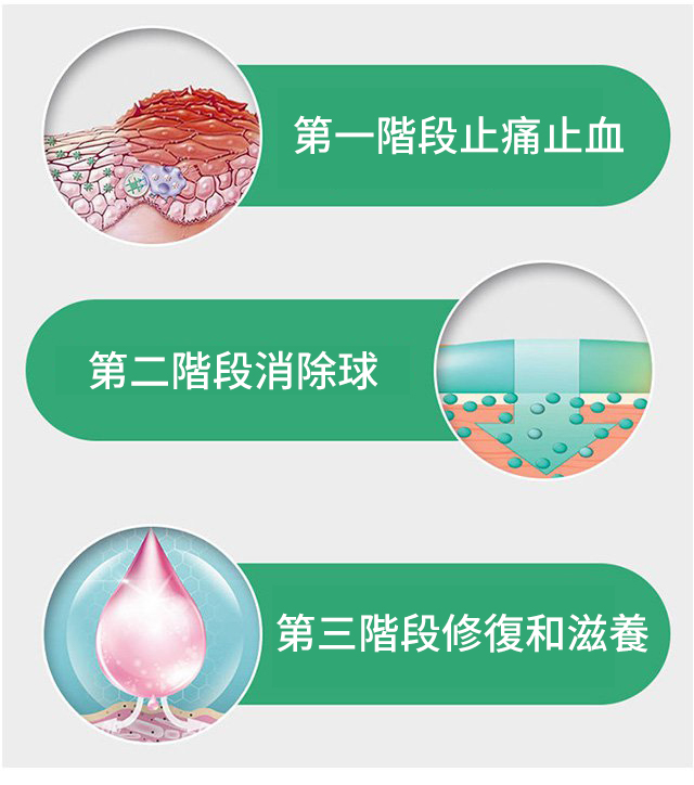 1635484695 16 EELHOE天然草藥噴霧舒緩腫脹痔