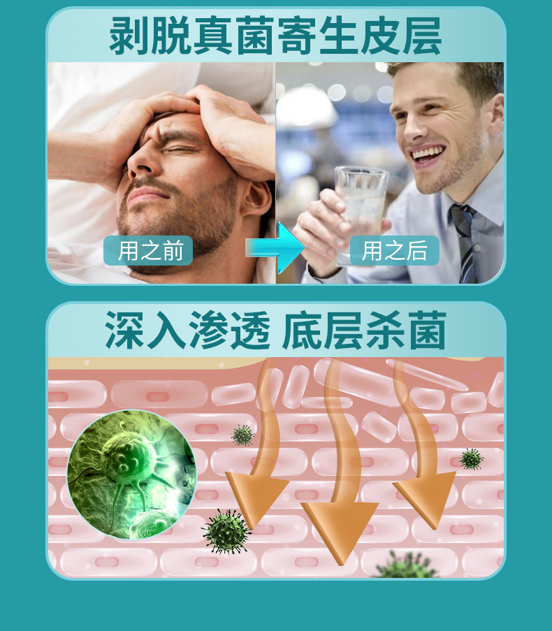 1638440132 %E7%97%94%E7%96%AE%E8%86%8F 13 苗先鋒痔瘡膏消肉球外用雲南本草斷痔膏內外混合瘡藥